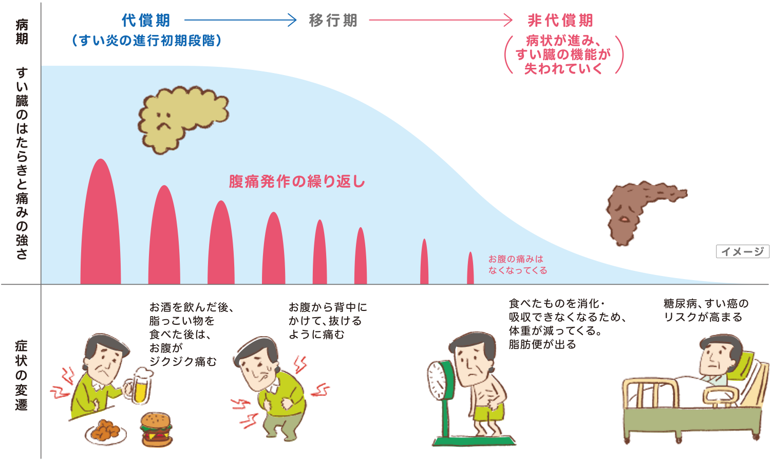 グラフ:病期/すい臓のはたらきと痛みの強さ/症状の変遷