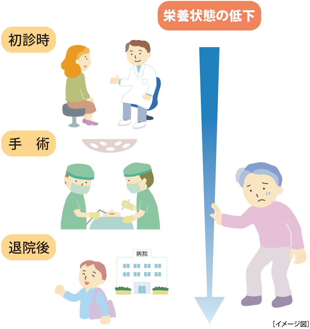 栄養状態の低下(イメージ図)
