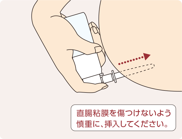 使用方法④ 肛門にアプリケーターを挿入