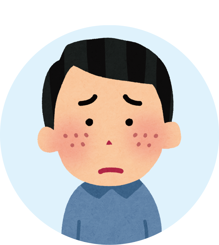 イラスト：ざ瘡（にきび）