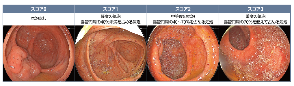気泡スコアを示す画像